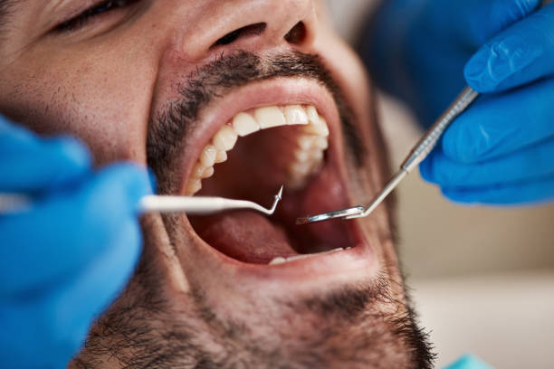Best Emergency Dental Care for Broken or Chipped Teeth in Carbonville, UT